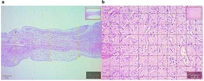 Induced membrane technique using bone cement with or without cefazolin in chicken segmental radius defect